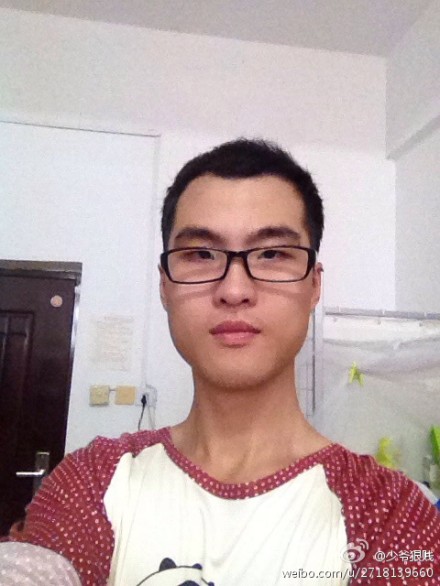 【成长记录】头发恢复历程