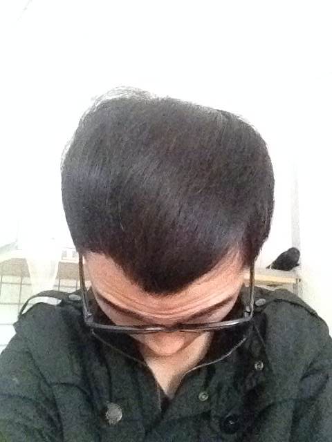 【成长记录】头发恢复历程